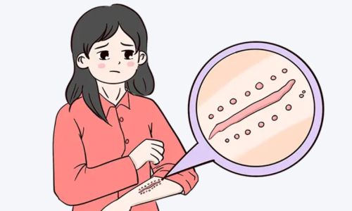 徐靖宏医生去疤痕的评价和口碑好吗？术后恢复体验、服务细节全面公开