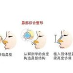 上海陈付国和钱玉鑫隆鼻哪个好？无假体妈生鼻vs直鼻微翘精致派！含价格