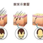 测评|西安植发医生哪个好？交大一附院赵文伟、二附院谭宣丰、星美的冀宝…