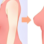 栾杰医生做的自体脂肪隆胸怎么样？技术特点、术后风格和关注点解析