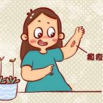 贵州人民医院杜娇怎么样？技术精湛，经验丰富！附价格表