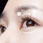 吴焱秋修复到底好不好？技术好，擅长项目：双眼皮修复、初次双眼皮手术…