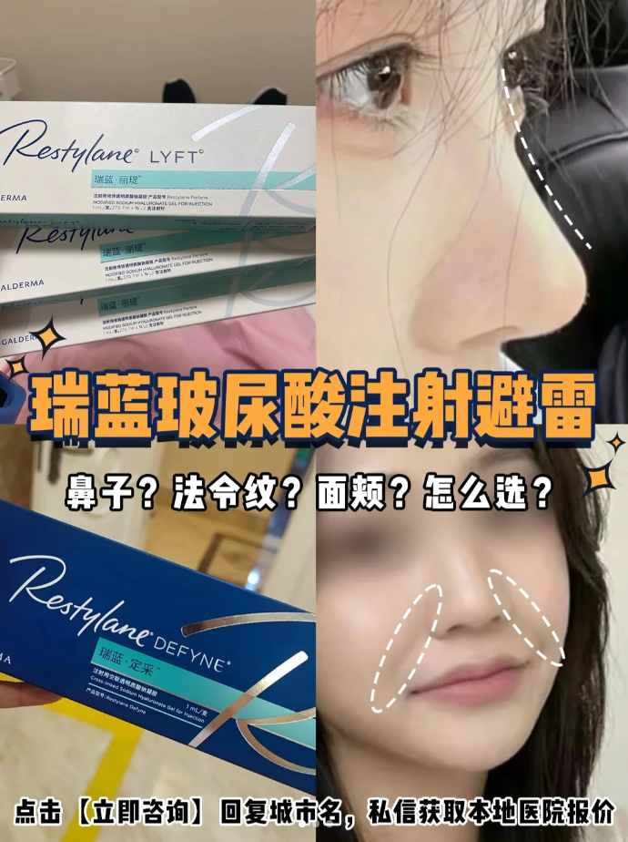 玻尿酸瑞蓝：美丽肌肤的隐形守护者|玻尿酸瑞蓝注射效果与安全性分析