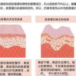 2026北京胶原蛋白填充医院排名口碑名单披露！医生实力与价格对比
