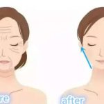 重庆星荣整形李世荣和吴一如何选？2026面部年轻化对比，各有杀招/拉皮拿手