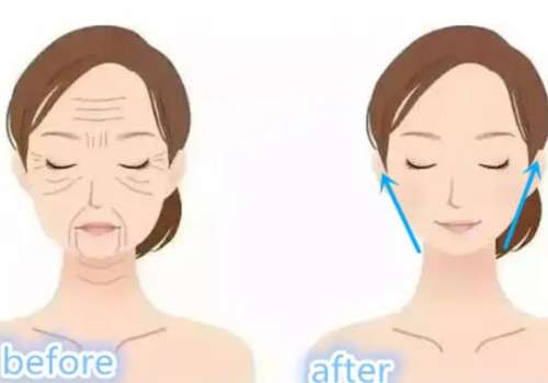 重庆星荣整形李世荣和吴一如何选？2026面部年轻化对比，各有杀招/拉皮拿手