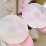 英国娜高假体丰胸怎么样？隆胸要多久恢复？