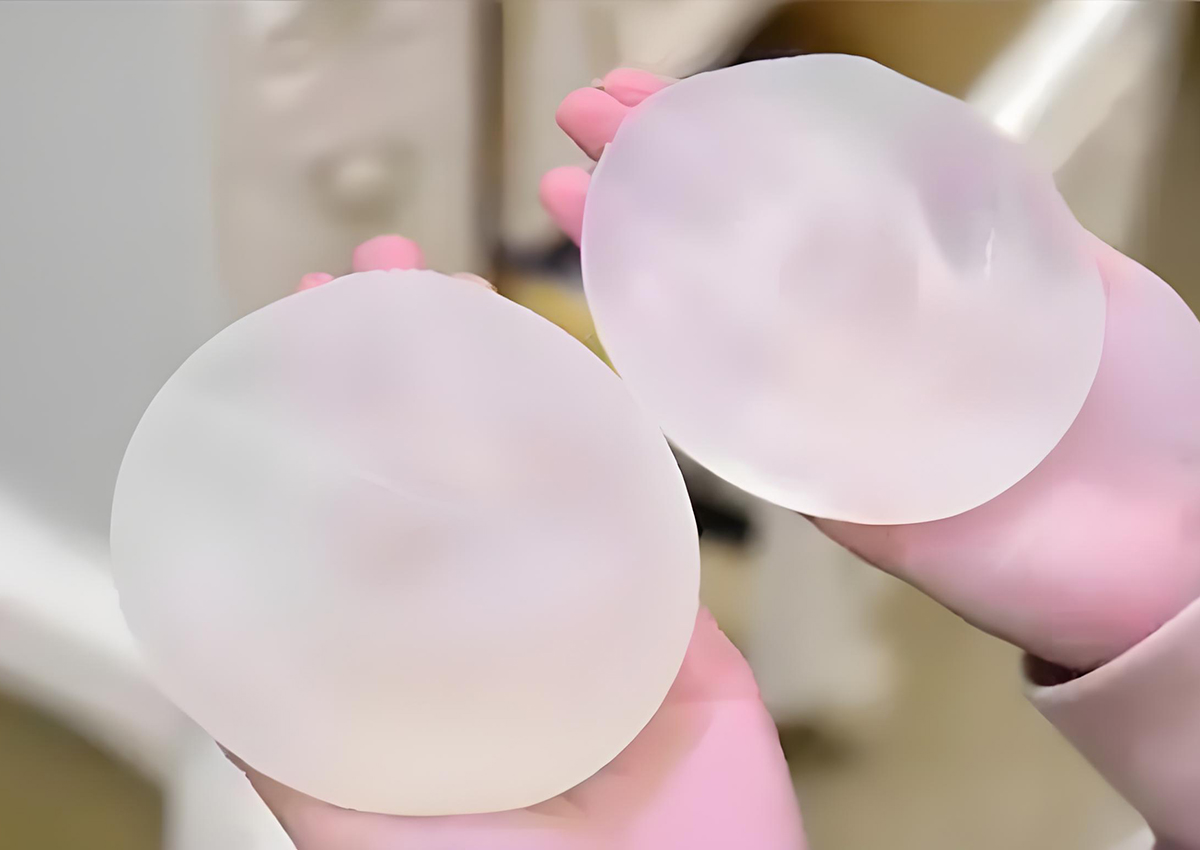 英国娜高假体丰胸怎么样？隆胸要多久恢复？