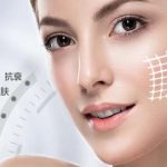 陈文才医生微创筋膜提升怎么样？术后恢复过程+风险避坑指南