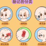 上海九院陈辉和罗旭松谁手术做胎记好？2026技术比拼、各有千秋！