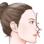 唐修俊做鼻子怎么样？多少钱？技术精湛_低至11000元起！