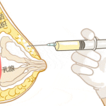 王志国隆胸是做的脂肪胶吗？常用方式、材料选择和适应人群一次说明白