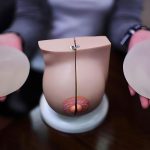 选择假体隆胸要注意什么| 隆胸的手术方式如何选择?