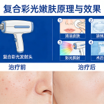 复合彩光嫩肤价格多少合适？效果怎么样？