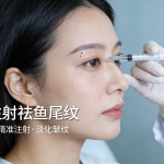 注射祛鱼尾纹的原理、效果及注意事项