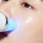 彩光嫩肤美白效果与原理解析，彩光嫩肤美白如何改善肤色不均和暗沉