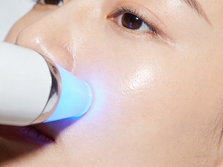 彩光嫩肤美白效果与原理解析，彩光嫩肤美白如何改善肤色不均和暗沉