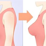 自体脂肪移植隆胸(自体脂肪移植隆胸有后遗症吗)