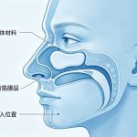 膨体隆鼻后要多久消肿？