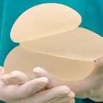 隆胸假体取出手术过程与恢复期全解答