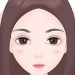 苏州市立医院赵斌做双眼皮手术怎么样？成果很好！能实现宛如天生感