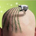 陈露露植发怎么样？技术优势点评、坐诊机构、植发案例点评