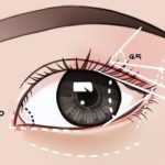 李向东医生简介及个人资料_成都如妍坐诊_眼部整形专家