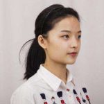 北京八大处解芳下颌角面诊感受，真人案例点评
