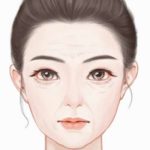 北京高亚东拉皮手术案例分析