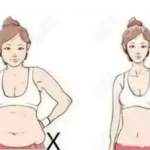 腹部抽脂让游泳圈快速消失