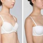 胸部无痕隆乳术——超完美的隆胸方法
