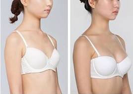 胸部无痕隆乳术——超完美的隆胸方法