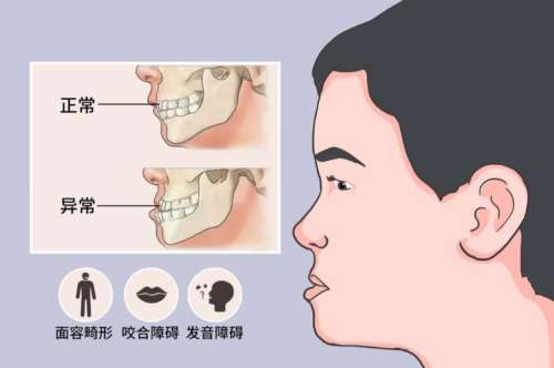 朱石江颌面手术怎么样？沈阳杏林磨骨专家，价格38000元起！