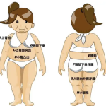腹部抽脂有哪些你需要了解的注意事项