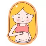想做剖腹产疤痕修复手术的姐妹这些注意事项你一定要知道。