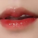 做完唇部综合要多久才能恢复？