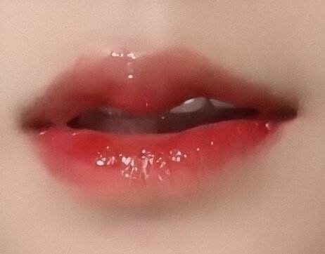 做完唇部综合要多久才能恢复？