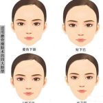 南京下颌角手术都有哪些专家？于攀、沈干等5大口碑医生测评