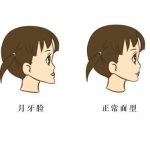 重庆颏成型医生肖林与刘正茂哪个水平高?各有千秋，来看详情分享