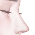 龙飞鼻整形怎么样？审美自然|手法精细|人气很高！