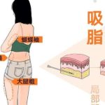 昆明吸脂做得比较好的医生有哪些？5位实力派医生名单在这看