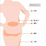 双下巴吸脂的操作方式及护理