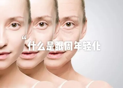 让眼部年轻的方式有哪些？