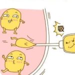 做了吸脂手术之后怎样才能快起恢复？
