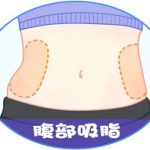 佛山吸脂做得比较好的医生有哪些？这5位值得推荐
