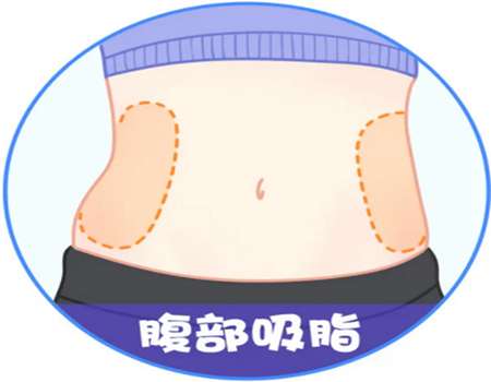 佛山吸脂做得比较好的医生有哪些？这5位值得推荐
