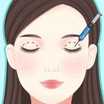 成都何莎双眼皮口碑怎么样？真实反馈+4年经验、术后自然没有痕迹