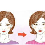 面部吸脂的价格受哪些因素的影响北京画美医疗美容医院为你解答