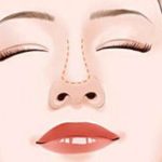 邵阳隆鼻好的医生有哪些？徐维东、谢江名、肖阳都很不错