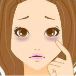 做了超声法去黑眼圈手术后应该如何护理？